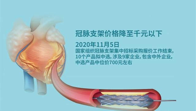 Heart Stent only US$105 in China