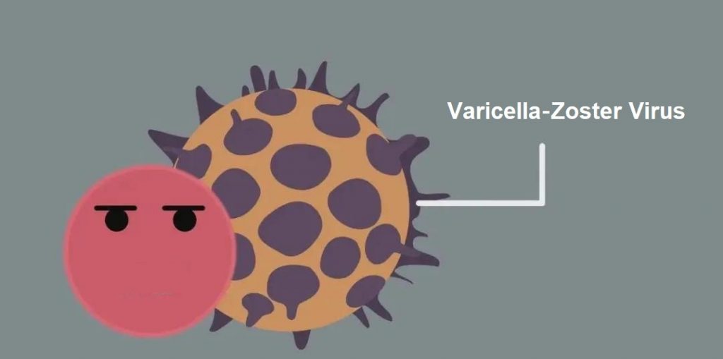 Varicella Zoster Virus and Vaccines