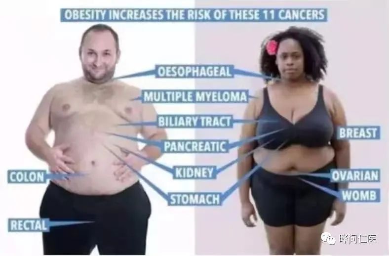 Obesity makes tumor cells more active!