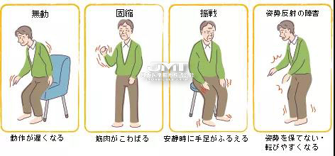 How to treat Parkinson's disease in Japan?