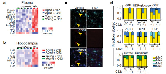 Nature: Let the brain return to youth! Restarting macrophage metabolism