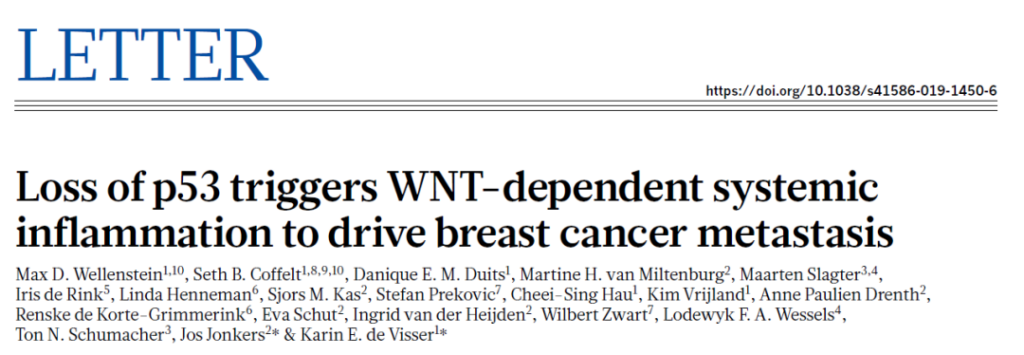 Breast cancer: P53 deletion promotes cancer cell metastasis