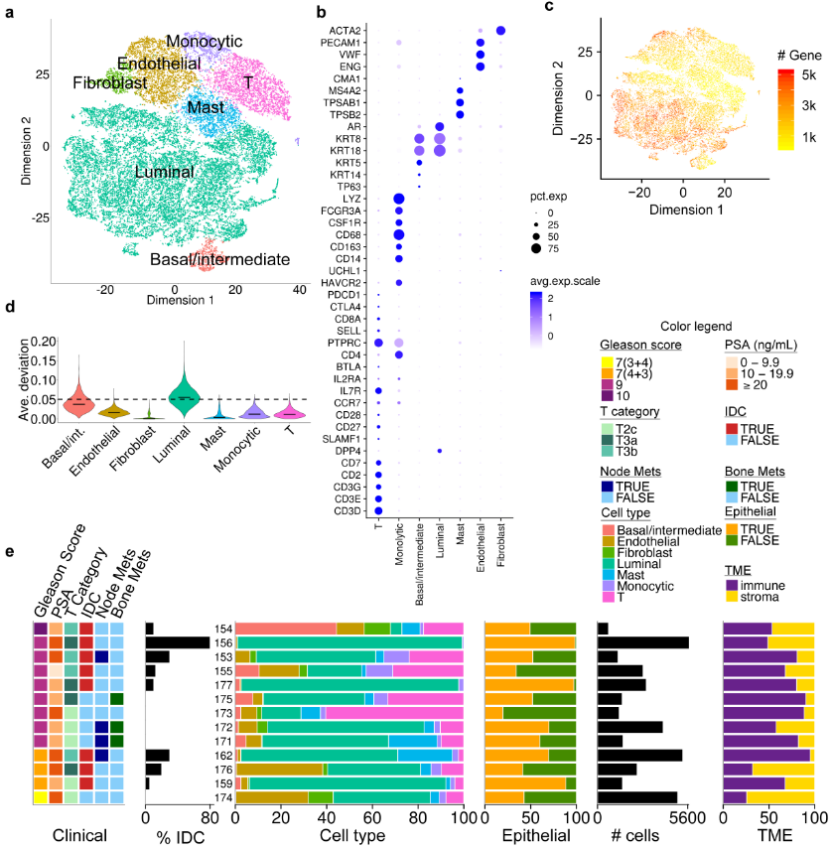 Dynamic reorganization of the tumor microenvironment in the progression of prostate cancer
