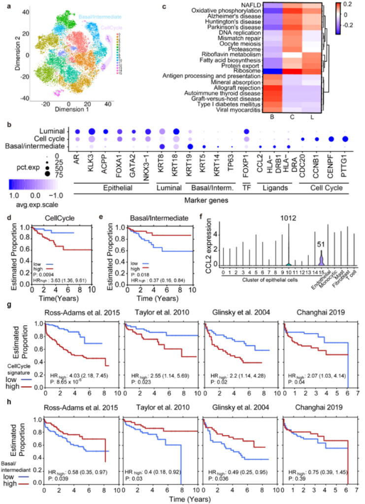 Dynamic reorganization of the tumor microenvironment in the progression of prostate cancer
