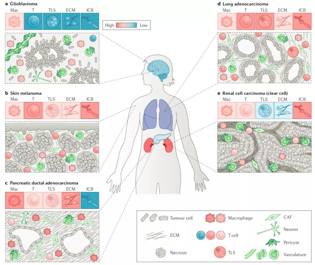 Differences immune microenvironment of various tumors