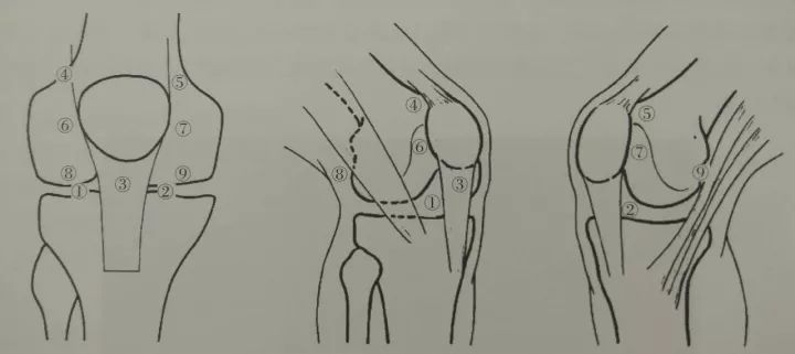Arthroscopic synovectomy: The main points Difficulties and Countermeasures