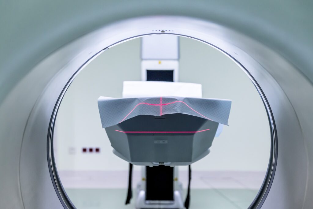 Is radiotherapy effective for brainstem glioma?