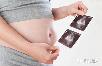 Five questions you have to know about NT examination during pregnancy!
