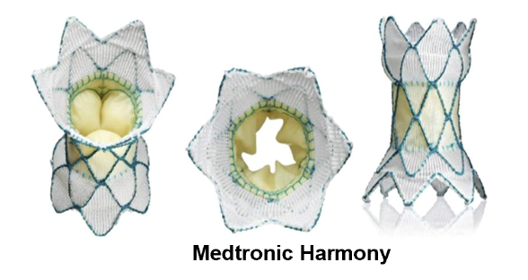 The world's first Medtronic's Harmony TPV valve Approved by FDA!