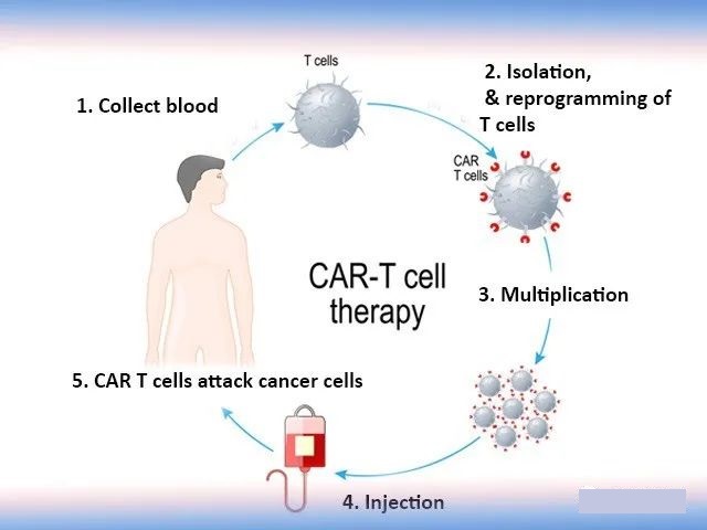 CAR-T therapy upgraded:  Finding effective targets to treat cancers