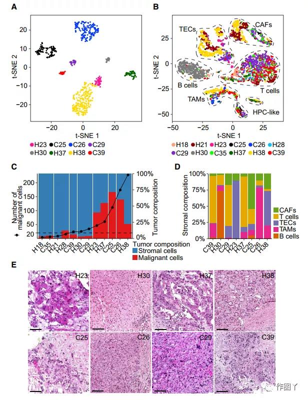 The diversity of tumor cells drives the reorganization of the liver cancer microenvironment