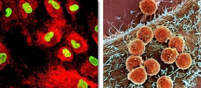 Stem cell knowledge: the difference between immune cells and stem cells