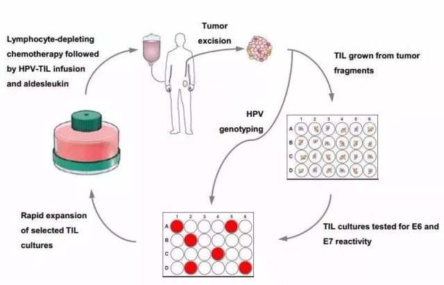 TILs Cell Therapy: An important hope to conquer tumors