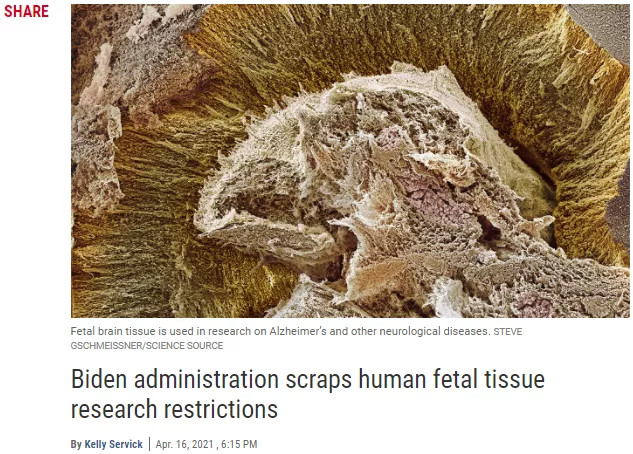 United States Government lifts research restrictions on human fetal tissues