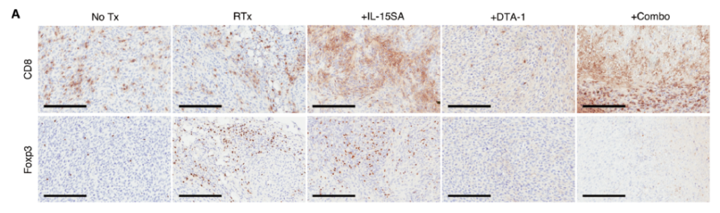 In this study, the researchers used interleukin-15 (IL-15) that does not stimulate Treg cells in combination with sub-debridement radiotherapy, and proved that this combination therapy can induce memory cell toxicity mediated by CD8+ T cells Anti-tumor immune response.