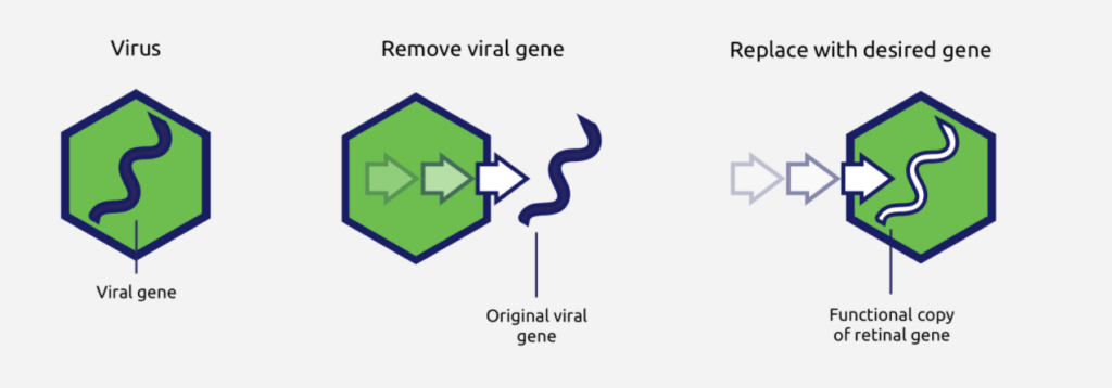 Viral vector-based therapeutic drugs for genetic diseases