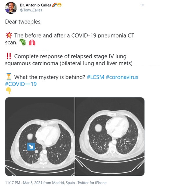 Can COVID-19 vaccine also "anti-cancer"?