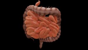3 signs may be polyps in the intestine or bowel cancer later