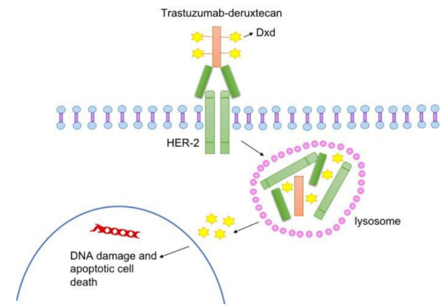 Trastuzumab Deruxtecan: Big change in treatment of HER-2+ solid tumors