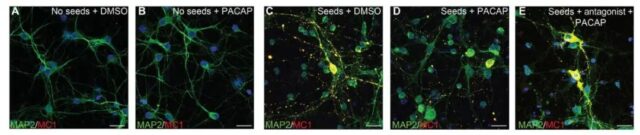 New target for Alzheimer: Target Activation of PAC1R and Clear Toxic Protein