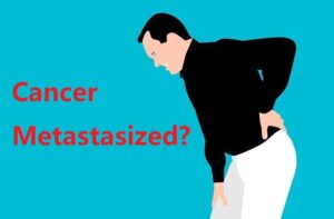 Metastatic cancer: What does it mean if cancers spread and metastasize?