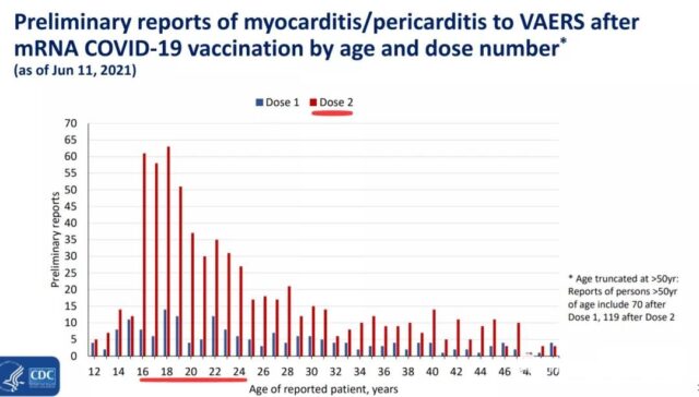 CDC: Cardiac inflammation much possibly linked to mRNA COVID-19 vaccines