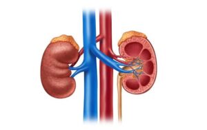 At what age is the high incidence of kidney cancer?