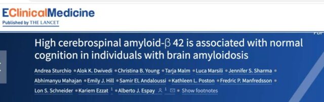 It's not Amyloid β plaquesdoes to cause Alzheimer’s disease
