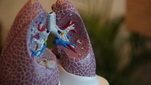 What do you need to do for lung cancer CT screening?