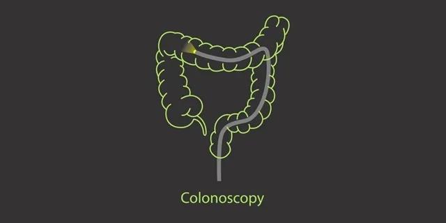 2021 USPSTF guidelines recommend colorectal cancer screening from age 45