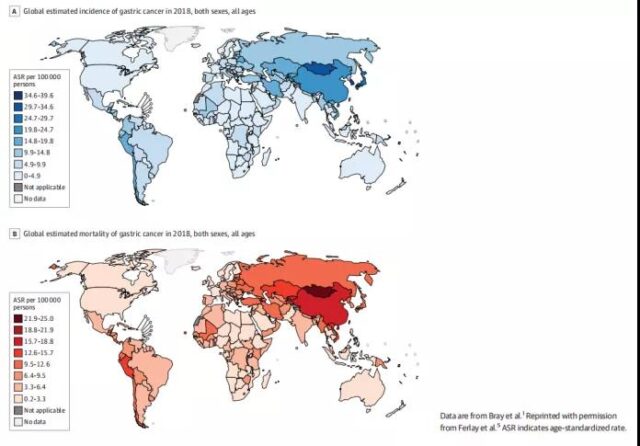 Global Incidence and Mortality of Gastric Cancer from 1980 to 2018
