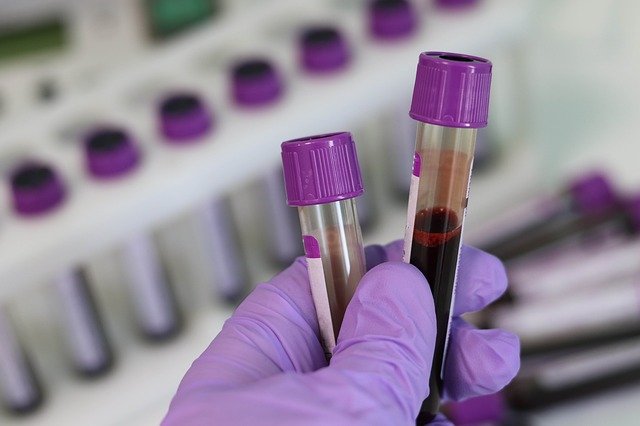 What diseases or cancers can be detected by blood routine? 
