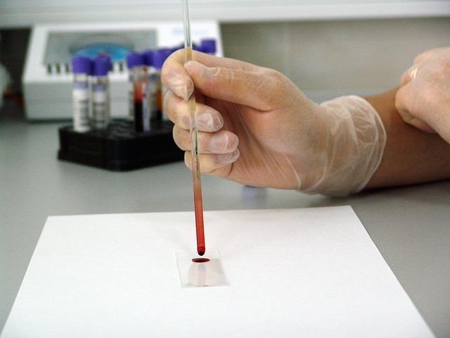 UK has launched a study on "blood cancer testing" for 160K people