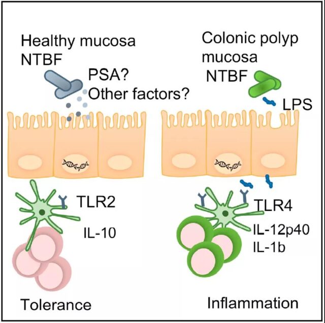 Cell Sub-Journal: This intestinal bacterium promotes carcinogenesis of colon polyps and can be used as a cancer predictor