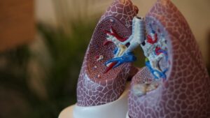 How to choose genetic testing methods for lung cancer?