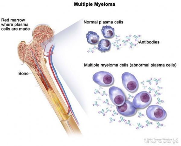 FDA approved Johnson & Johnson Darzalex Faspro for multiple myeloma!