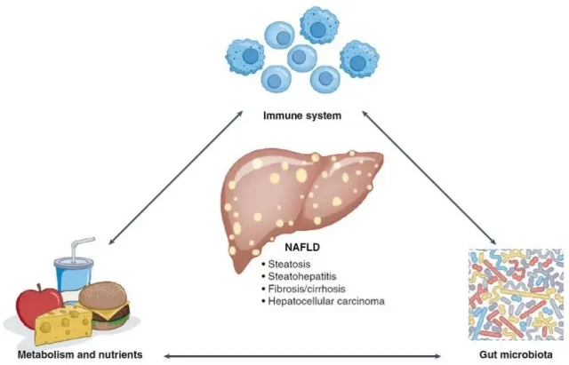 What are most important factors related to Non-alcoholic Fatty Liver?
