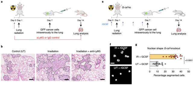 Nature Cancer: Radiotherapy makes neutrophils promote cancer? 
