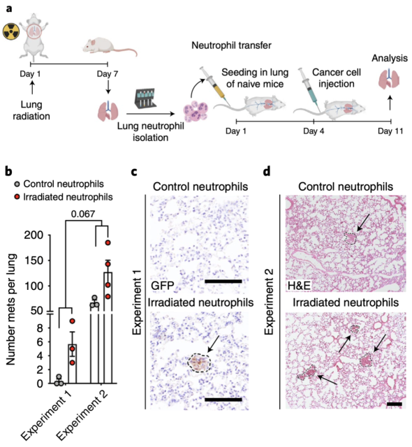 Nature Cancer: Radiotherapy makes neutrophils promote cancer? 