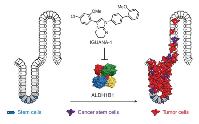 A new target for colorectal cancer treatment - ALDH1B1