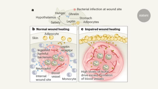 Immune cells use hunger hormones to help heal skin infections and wounds