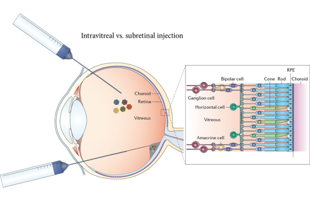 Optogenetic Ophthalmic Gene Therapy: Preclinical Data Misses Expectations