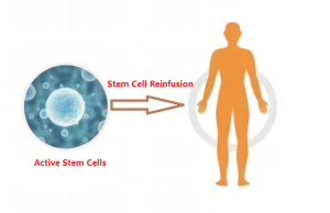 What are Stem Cell Reinfusion and related issues?