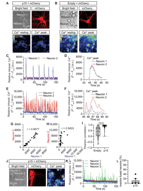 COVID-19 can cause brain cell fusion and impair neuron activity and brain function
