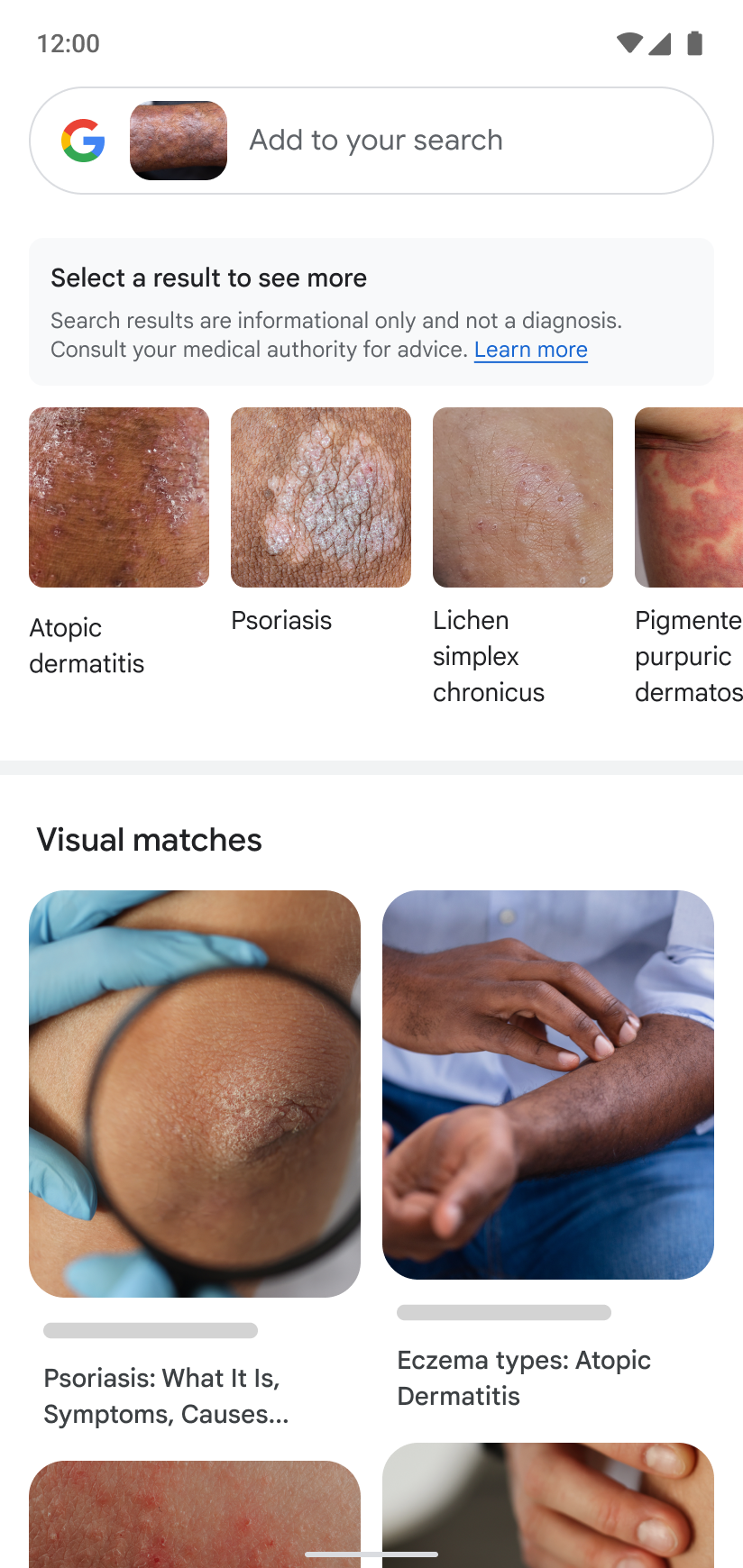 Google Lens can now help people compare their skin health
