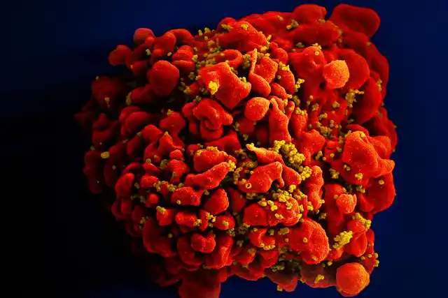 VIR-1388: Clinical Trial of Preventive HIV Vaccine Begins