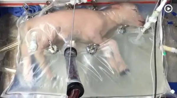 Could In Vitro Embryo Development Become a Reality? FDA Evaluates Artificial Womb Technology