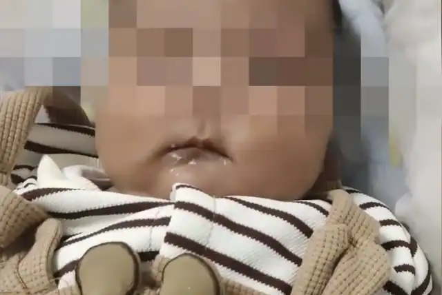 Two-Month-Old Infant Dies After Hepatitis B and PolioVaccination in China