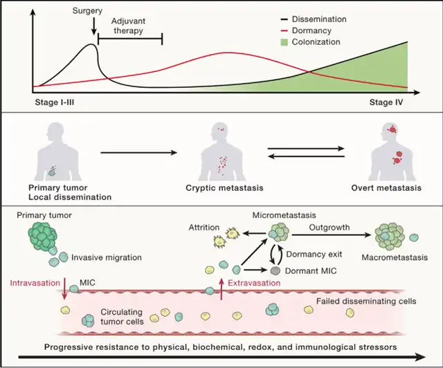 Cancer Metastasis: From Evolutionary Process to Therapeutic Opportunities