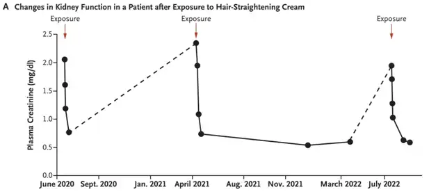 Hair straightening cream led to three episodes of acute kidney injury in two years